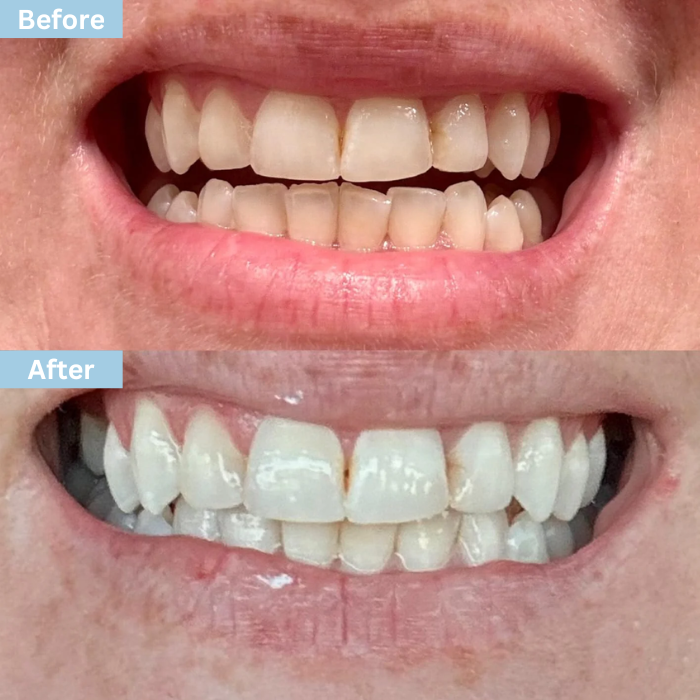 Glowflora™ Probiotic Whitening & Fresh Breath Toothpaste