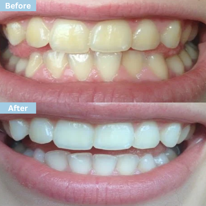 Glowflora™ Probiotic Whitening & Fresh Breath Toothpaste