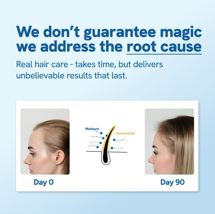 RootIgnite™ Instant Hair Regrowth Roll-On
