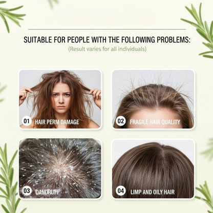 Roséa™ Rosemary Shampoo – Strengthens Weak Hair & Boosts Volume