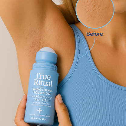 Bumpless™ Ingrown Hair Treatment Roll-On